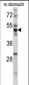 PDIA6 Antibody (Center K159)